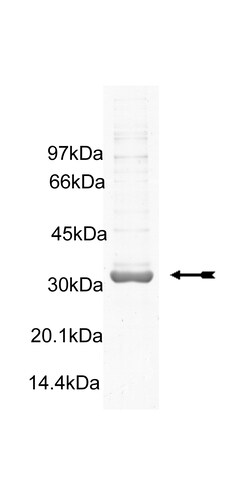 Eurofins DiscoverX FAK Protein, Active 250 &mu;g | Buy Online | Eurofins DiscoverX | Fisher Scientific